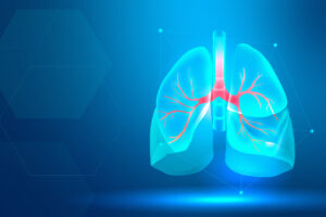 Tracheostomy