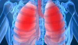 Respiratory Muscle Training